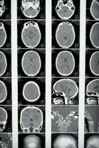 Brain scan images